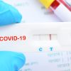 COVID-19 testing