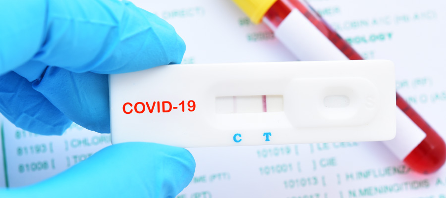 COVID-19 testing